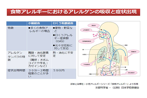 食物アレルギーにおけるアレルゲンの吸引と症状出現