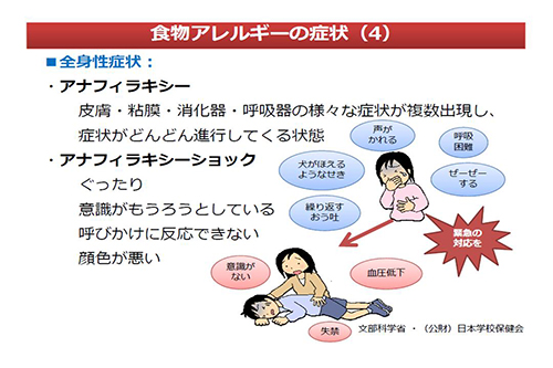 食物アレルギーの症状(3)