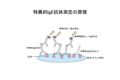 特異的lgE抗体測定の原理