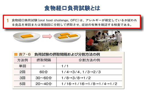 食物経口負荷試験とは