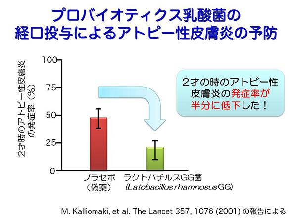 プロバイオティクス乳酸菌の経口投与によるアトピー性皮膚炎の予防